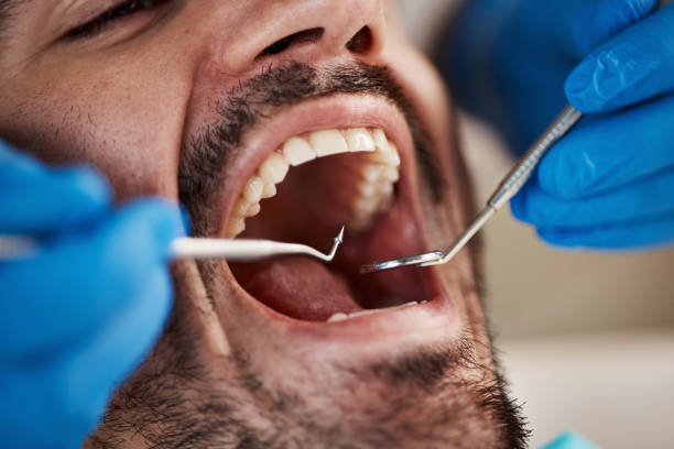 Best Chipped Tooth Repair Near Me  in Berwyn, IL