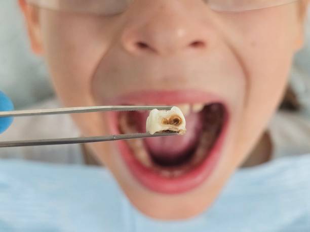 Emergency Dentist Open Today in IL
